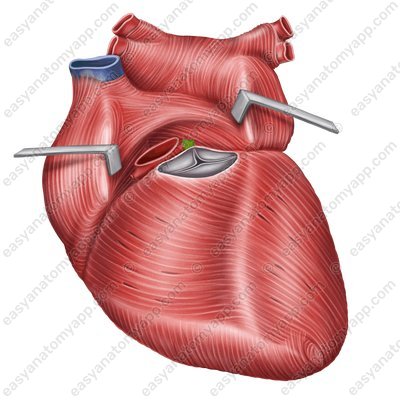 Left coronary artery (a. coronaria sinistra)